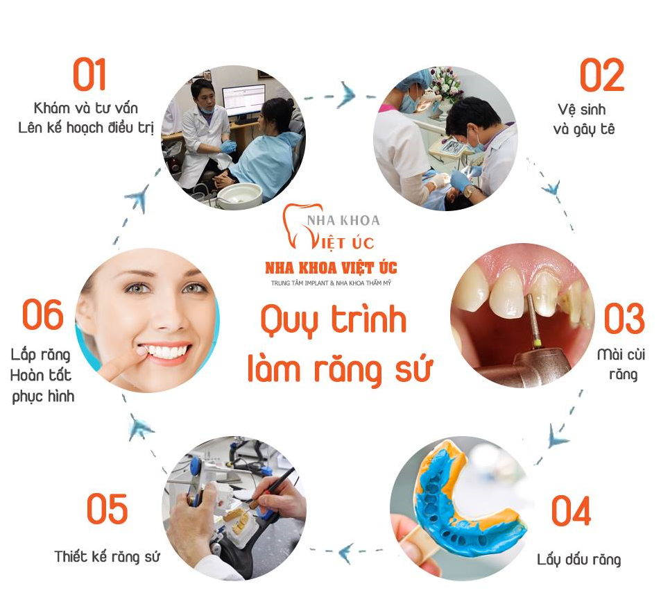 Bọc Răng Sứ - nhakhoadongnam.com: Giải Pháp Hoàn Hảo Cho Nụ Cười Tự Tin image-1748276308134