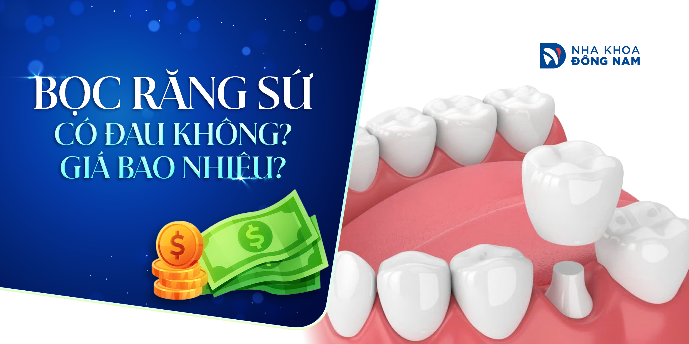 Bọc Răng Sứ - nhakhoadongnam.com: Giải Pháp Hoàn Hảo Cho Nụ Cười Tự Tin image-1748276311508