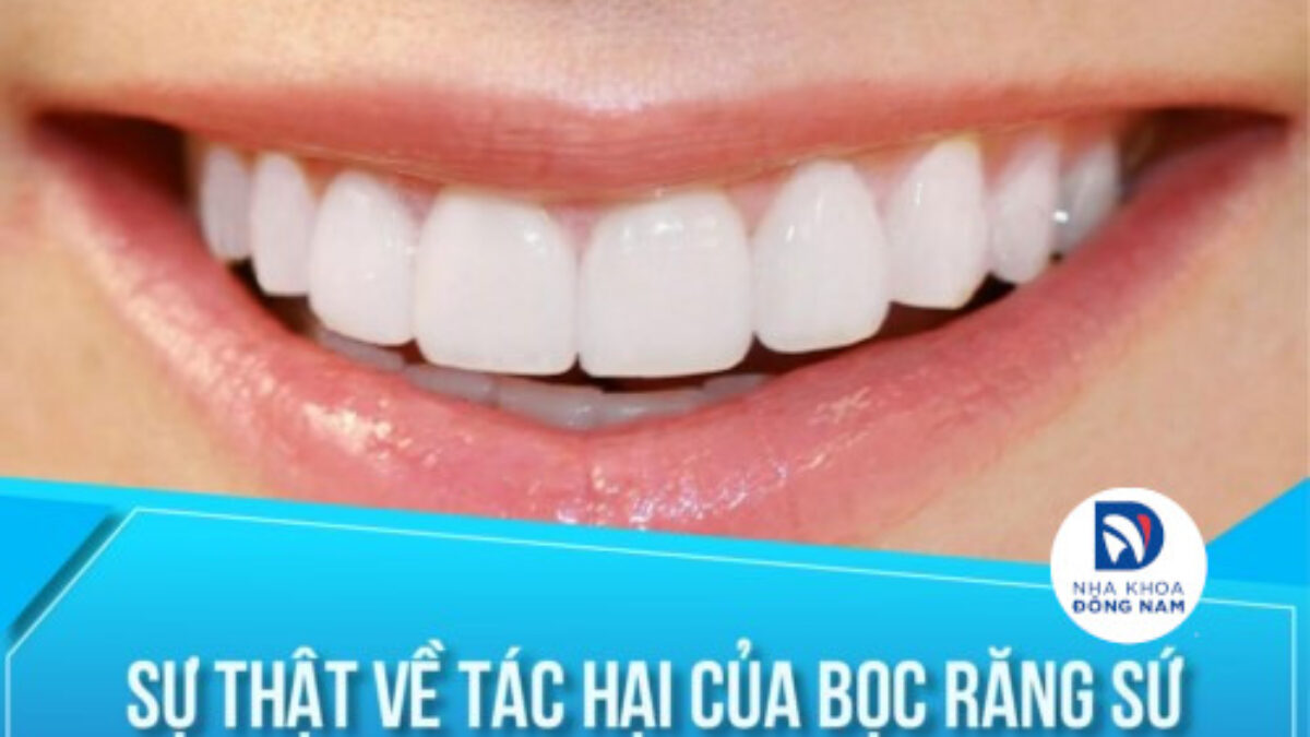 Bọc Răng Sứ - nhakhoadongnam.com: Giải Pháp Tái Tạo Nụ Cười Hoàn Hảo image-1748276665285