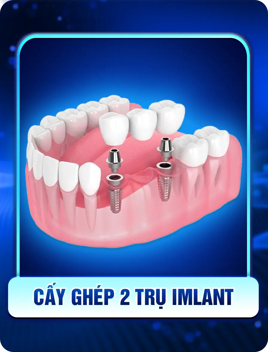 Cấy Ghép Implant - nhakhoadongnam.com: Giải Pháp Trồng Răng Hiện Đại Và Hiệu Quả image-1748276116463