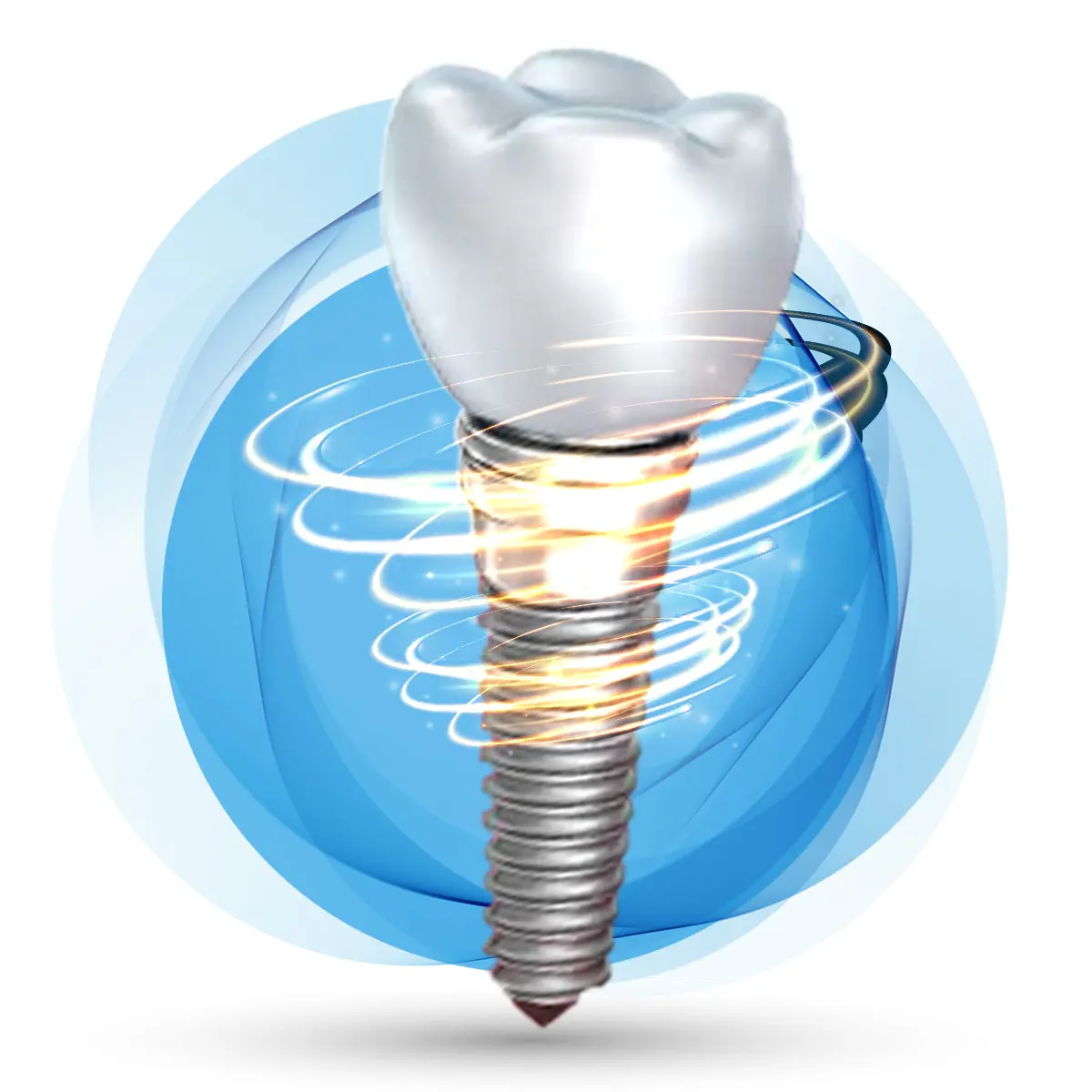Cấy Ghép Implant - nhakhoadongnam.com: Giải Pháp Trồng Răng Hiện Đại Và Hiệu Quả image-1748276118083