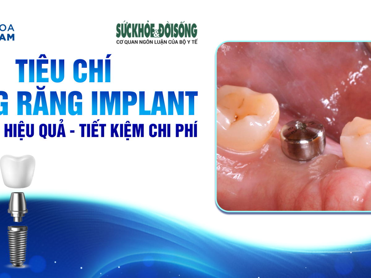 Cấy Ghép Implant - nhakhoadongnam.com: Giải Pháp Tối Ưu Cho Răng Mất image-1748276243136