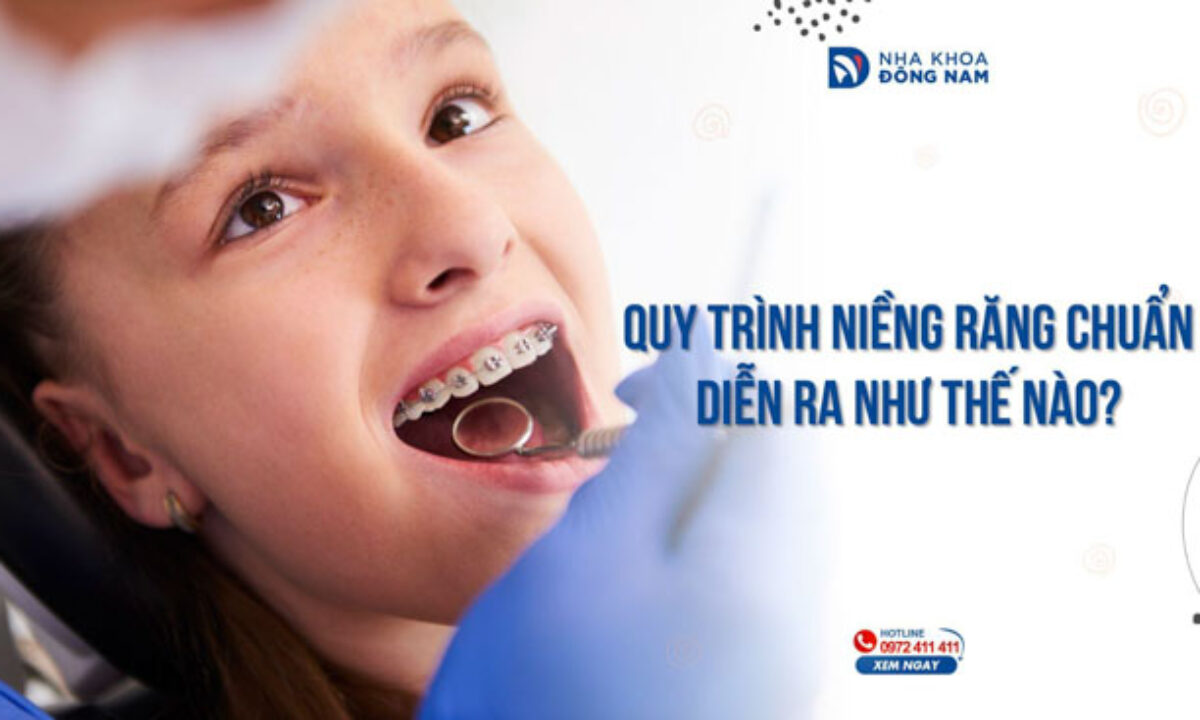 Chỉnh Nha - nhakhoadongnam.com: Giải Pháp Tối Ưu Cho Nụ Cười Tự Tin image-1748276630975