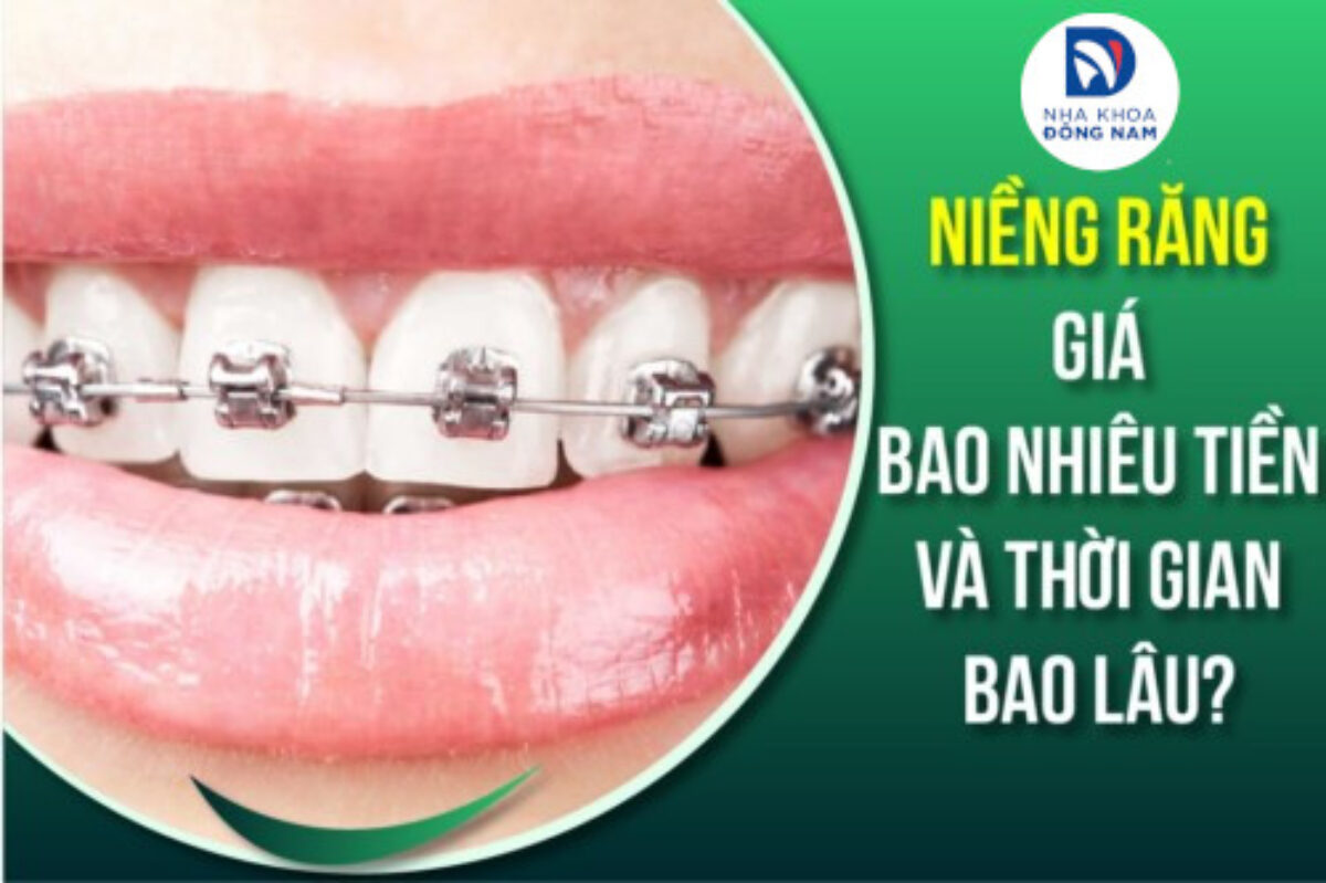 Chỉnh Nha - nhakhoadongnam.com: Giải Pháp Tối Ưu Cho Nụ Cười Tự Tin image-1748276633649