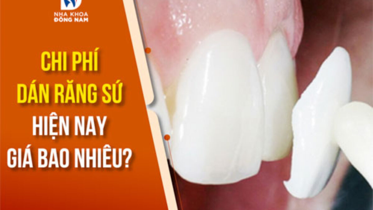 Dán Sứ Veneer - nhakhoadongnam.com: Bí Quyết Cho Nụ Cười Hoàn Hảo image-1748276774351