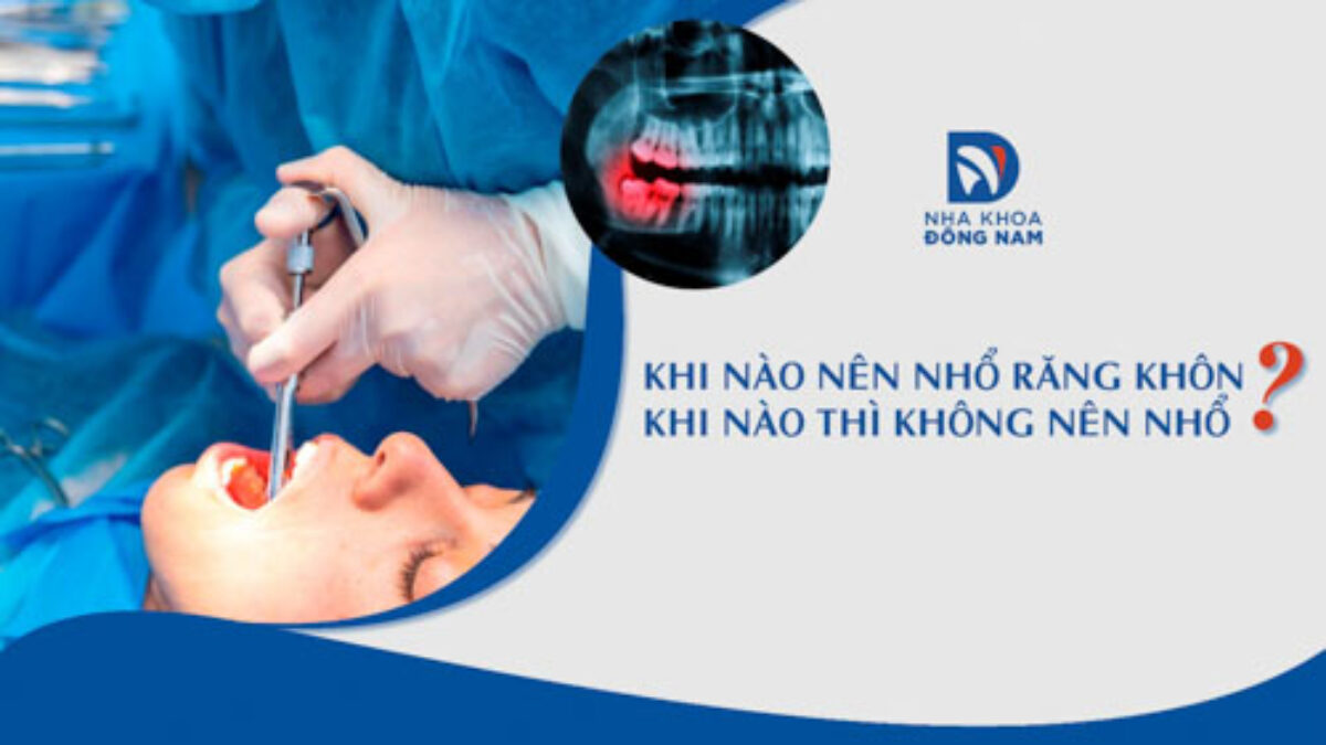 Nhổ Răng Khôn - nhakhoadongnam.com: Những Điều Cần Biết Trước Khi Thực Hiện image-1748276713042