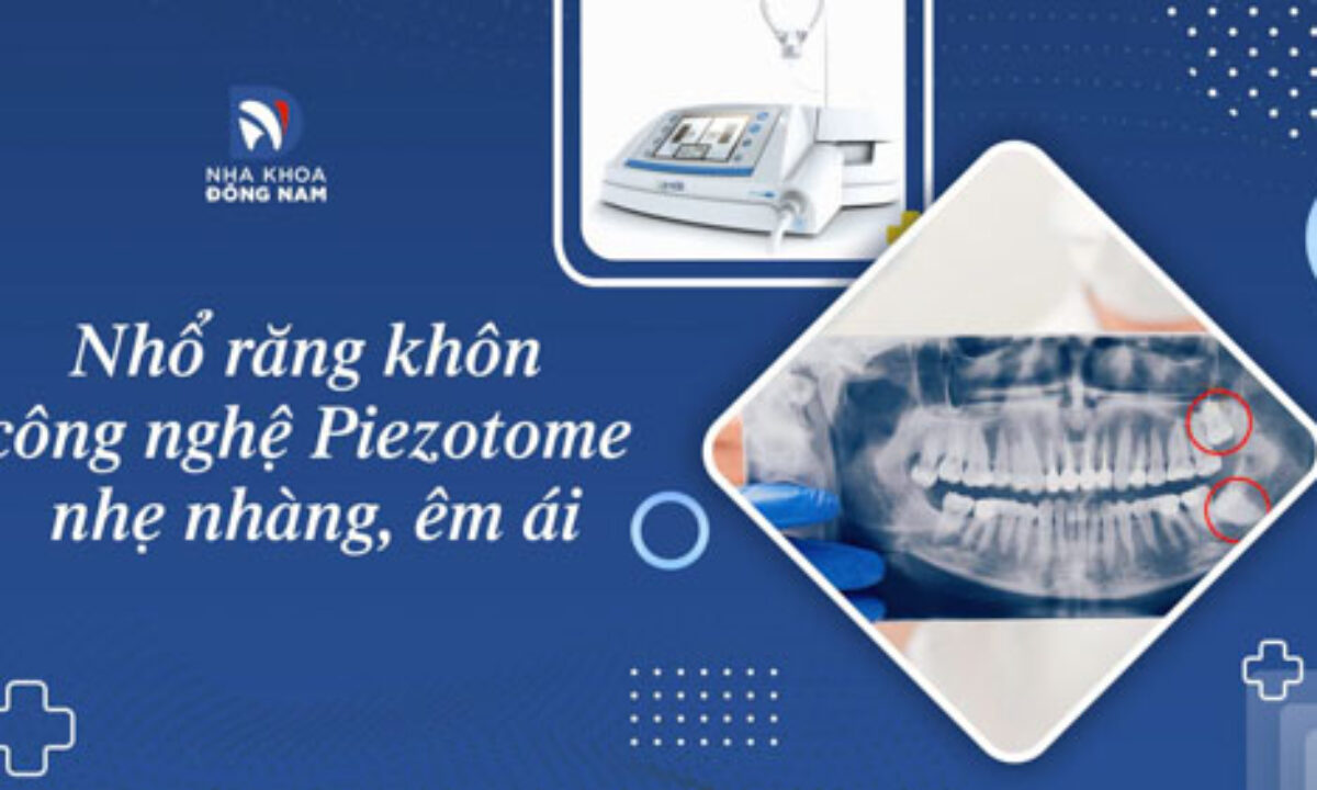 Nhổ Răng Khôn - nhakhoadongnam.com: Những Điều Cần Biết Trước Khi Thực Hiện image-1748276716514