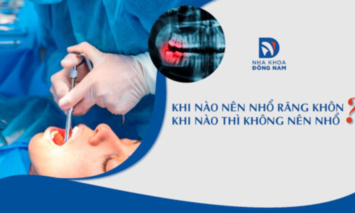 Nhổ Răng Khôn - nhakhoadongnam.com: Tất Tần Tật Bạn Cần Biết image-1748276849023