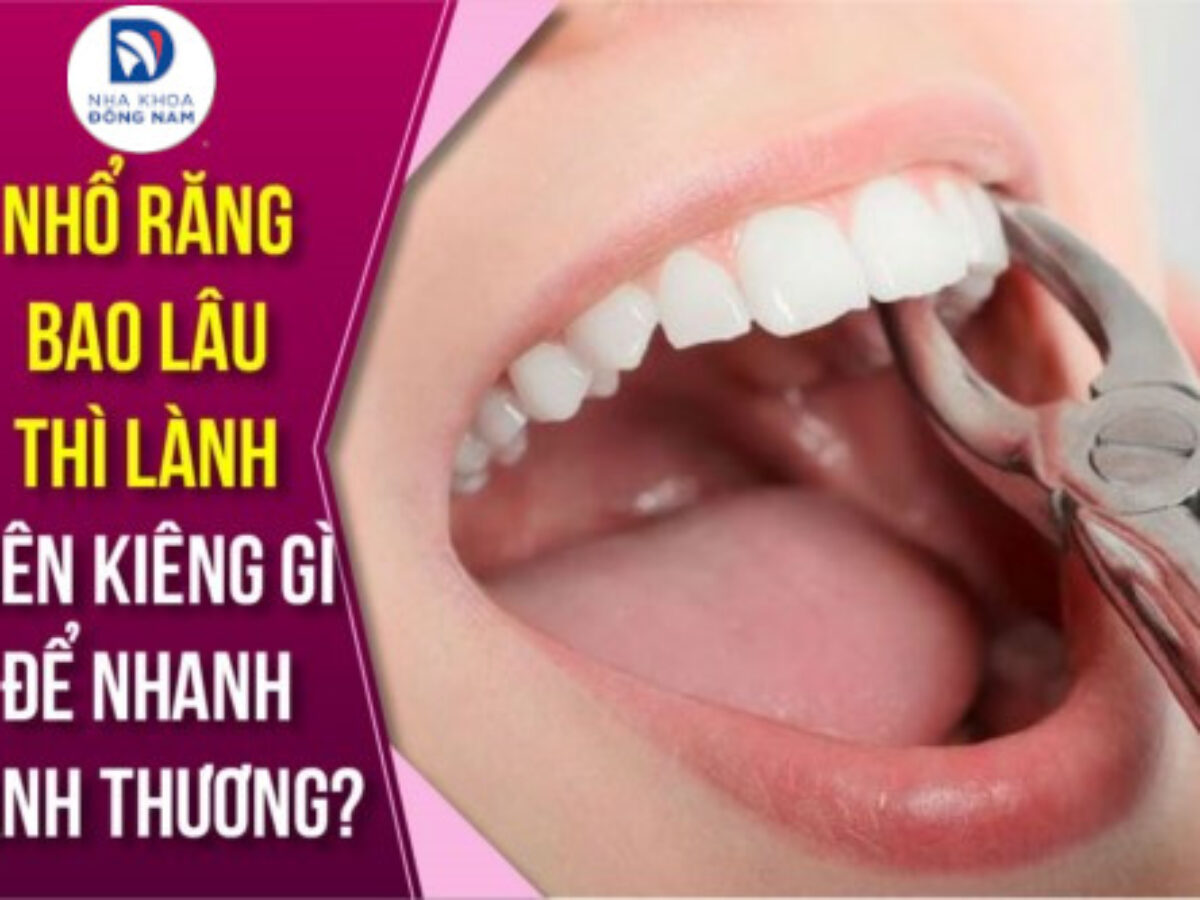 Nhổ Răng Khôn - nhakhoadongnam.com: Tất Tần Tật Bạn Cần Biết image-1748276851763