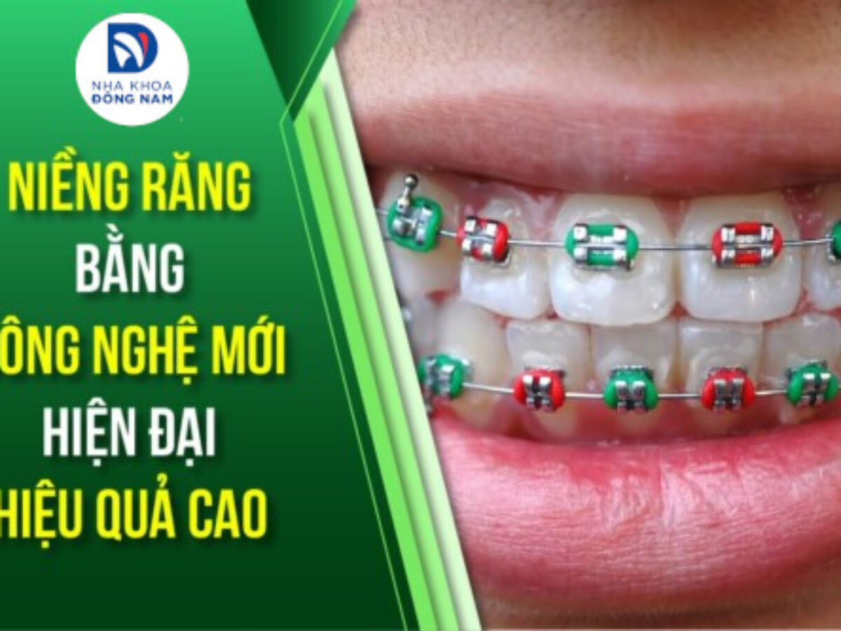 Niềng Răng - nhakhoadongnam.com: Giải Pháp Chỉnh Nha Hiệu Quả Và An Toàn image-1748276552069
