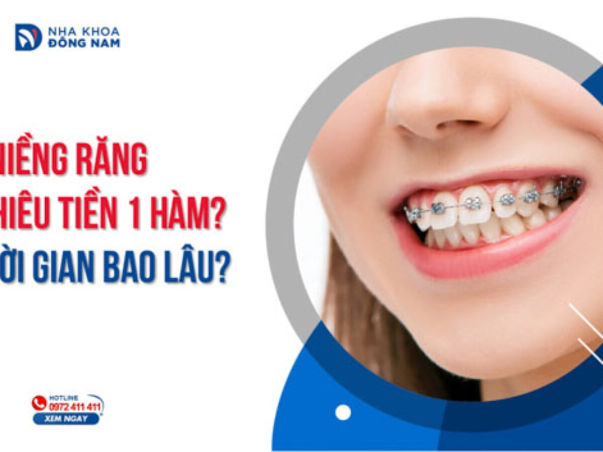 Niềng Răng - nhakhoadongnam.com: Giải Pháp Chỉnh Nha Hiệu Quả image-1748276692895