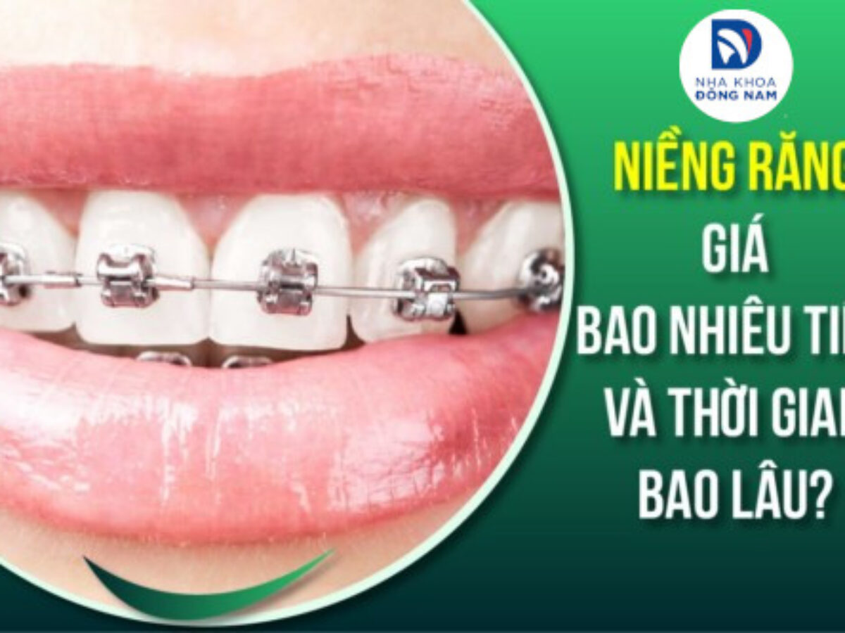 Niềng Răng - nhakhoadongnam.com: Giải Pháp Thẩm Mỹ Và Chức Năng Toàn Diện image-1748276945346