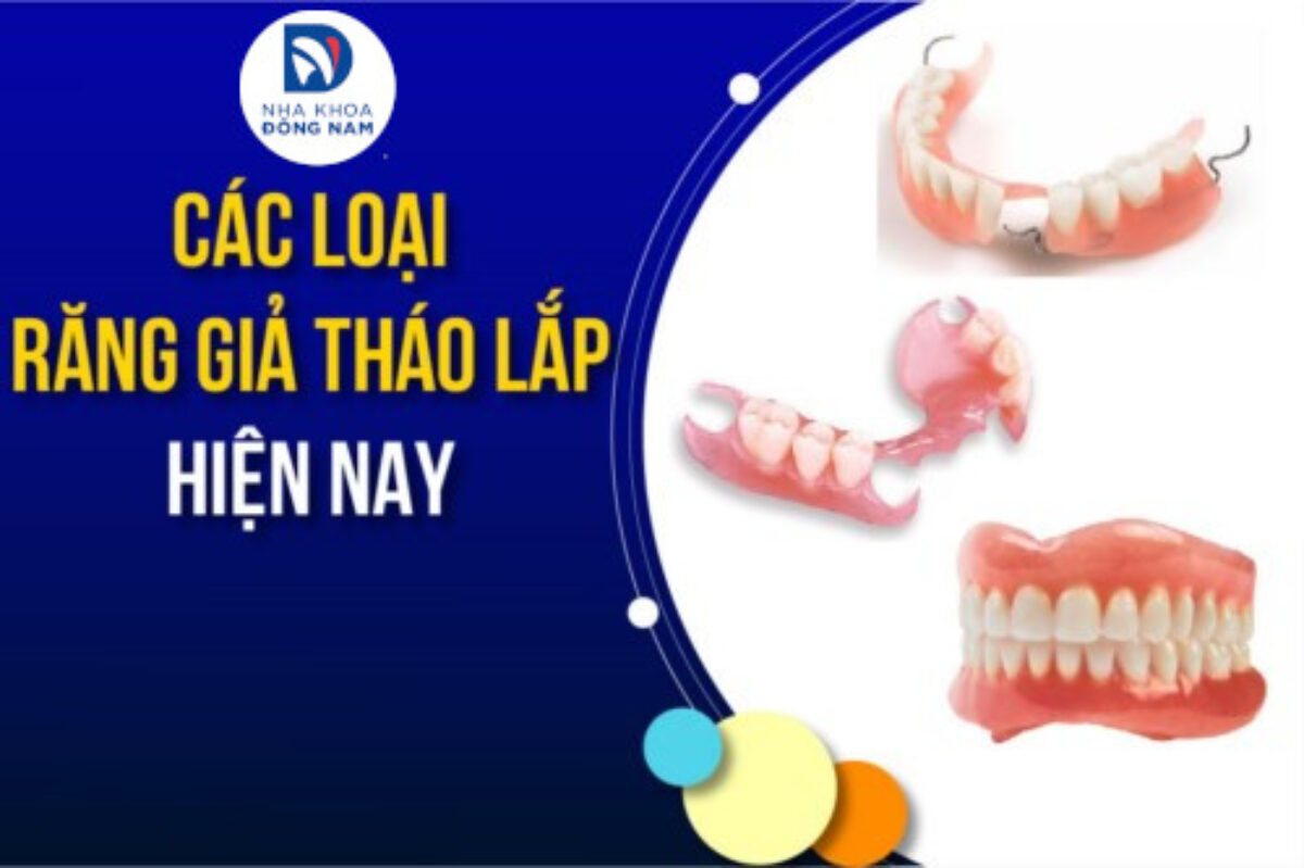 Răng Giả Tháo Lắp - nhakhoadongnam.com: Giải Pháp Phục Hình Hiệu Quả, Tiết Kiệm image-1748276789754