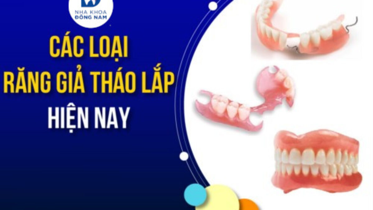 Răng Giả Tháo Lắp - nhakhoadongnam.com: Giải Pháp Phục Hình Hiệu Quả, Tiết Kiệm image-1748276790760
