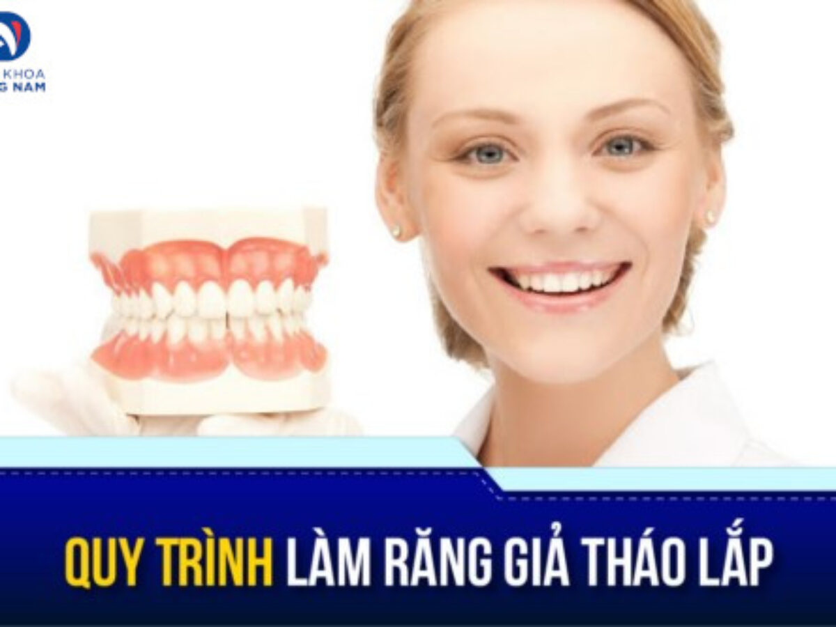 Răng Giả Tháo Lắp - nhakhoadongnam.com: Giải Pháp Phục Hình Hiệu Quả, Tiết Kiệm image-1748276791641