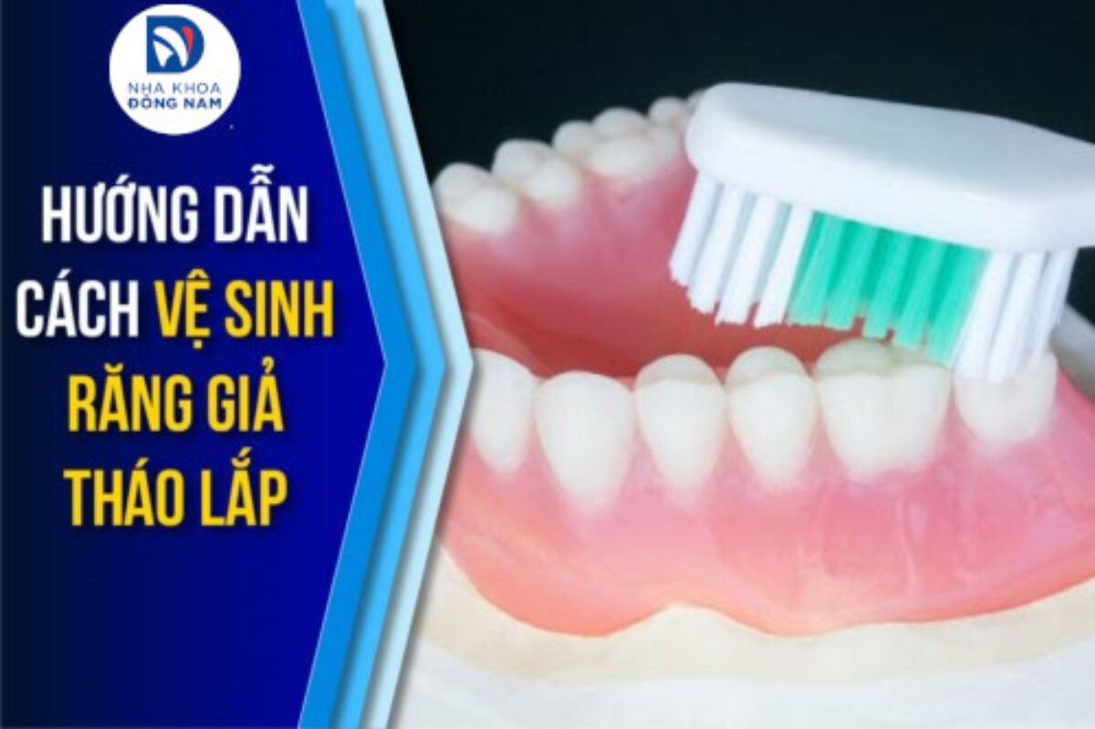 Răng Giả Tháo Lắp - nhakhoadongnam.com: Giải Pháp Phục Hình Hiệu Quả, Tiết Kiệm image-1748276792710