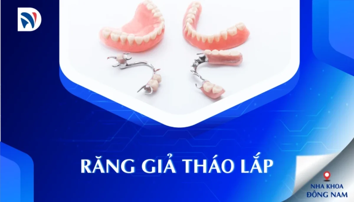 Răng Giả Tháo Lắp - nhakhoadongnam.com: Giải Pháp Phục Hồi Răng Mất An Toàn Và Hiệu Quả image-1748276932773