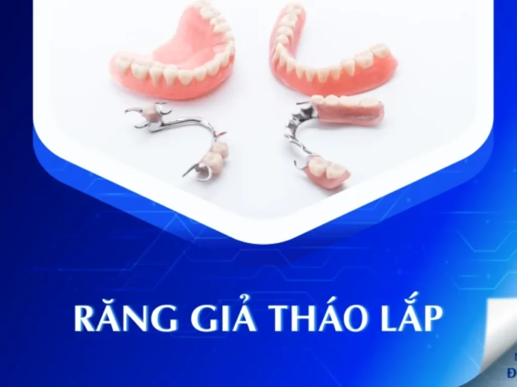 Răng Giả Tháo Lắp - nhakhoadongnam.com: Giải Pháp Phục Hình Kinh Tế Và Hiệu Quả image-1748277203957