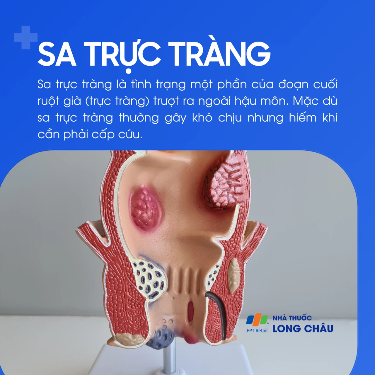 Tìm Hiểu Tất Cả Về SA Trực Tuyến: Nguyên Nhân, Dấu Hiệu Và Điều Trị image-1748535516402