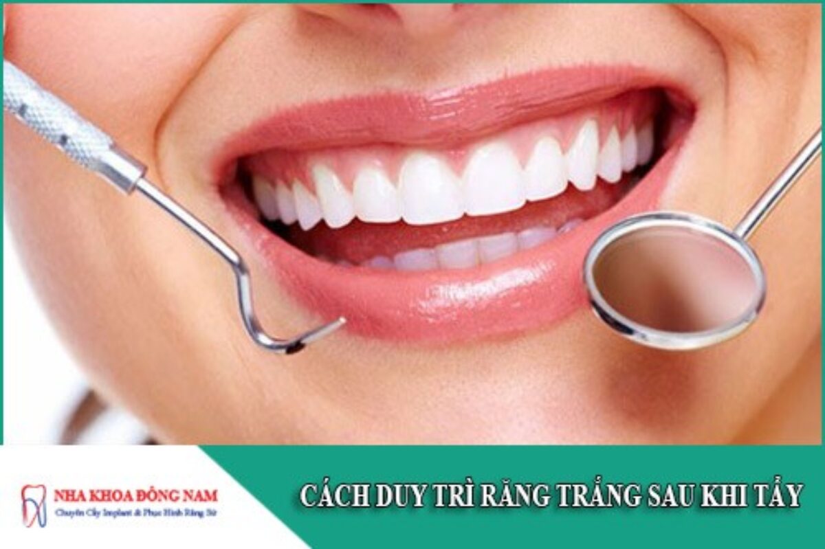 Tẩy Trắng Răng - nhakhoadongnam.com: Những Điều Bạn Cần Biết image-1748276629299