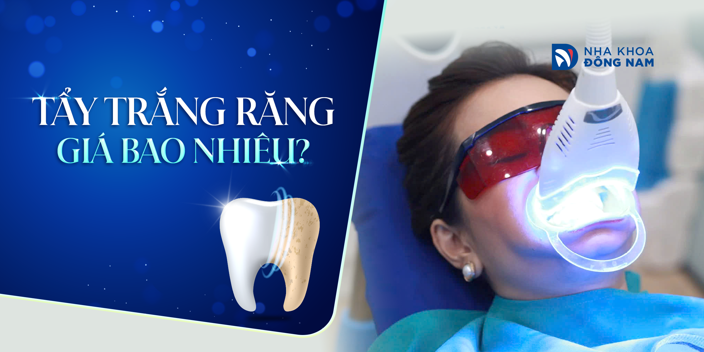 Tẩy Trắng Răng - nhakhoadongnam.com: Bí Quyết Cho Nụ Cười Tỏa Sáng image-1748276766271