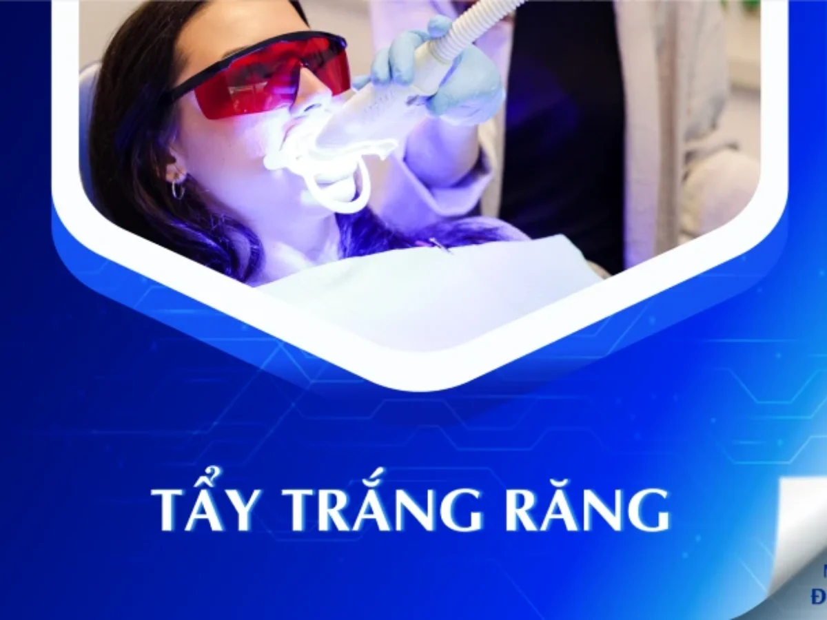 Tẩy Trắng Răng - NhaKhoaDongNam.com: Bí Quyết Cho Nụ Cười Tự Tin image-1748277014334