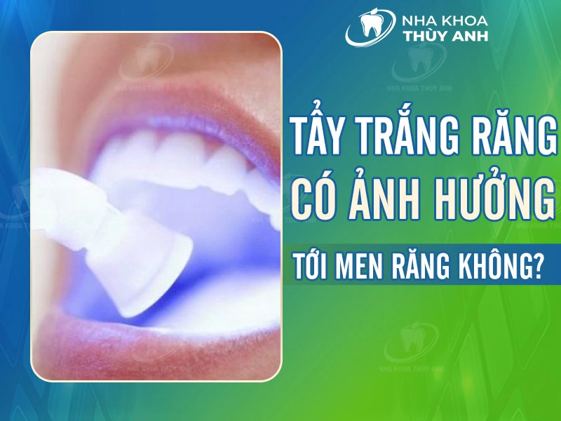 Tẩy Trắng Răng - NhaKhoaDongNam.com: Bí Quyết Cho Nụ Cười Tự Tin image-1748277032611
