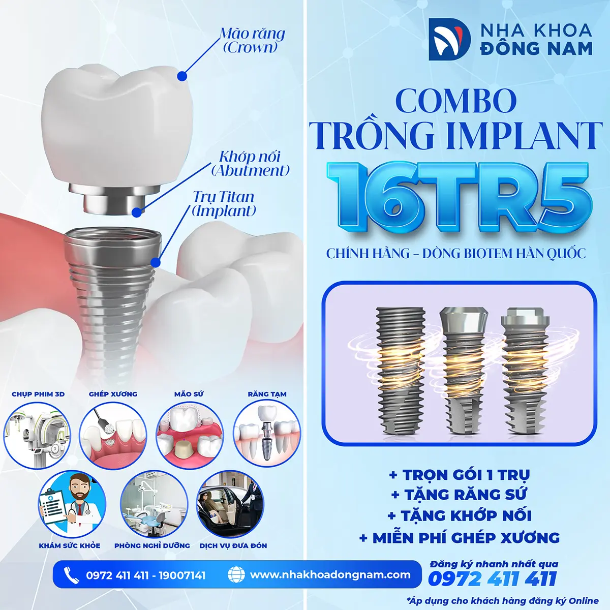 Trồng Răng Implant - nhakhoadongnam.com: Giải Pháp Hiệu Quả Cho Nụ Cười Hoàn Hảo image-1748276200922